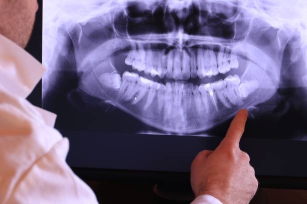 Best Emergency Tooth Extraction in Sulphur, OK